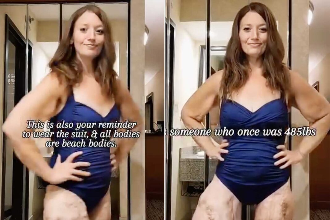 Fitness Influencer Lexi Reed, After 300-Pound Loss and Rare Disease Battle, Reclaims Her Power in Inspiring Swimsuit Reveal