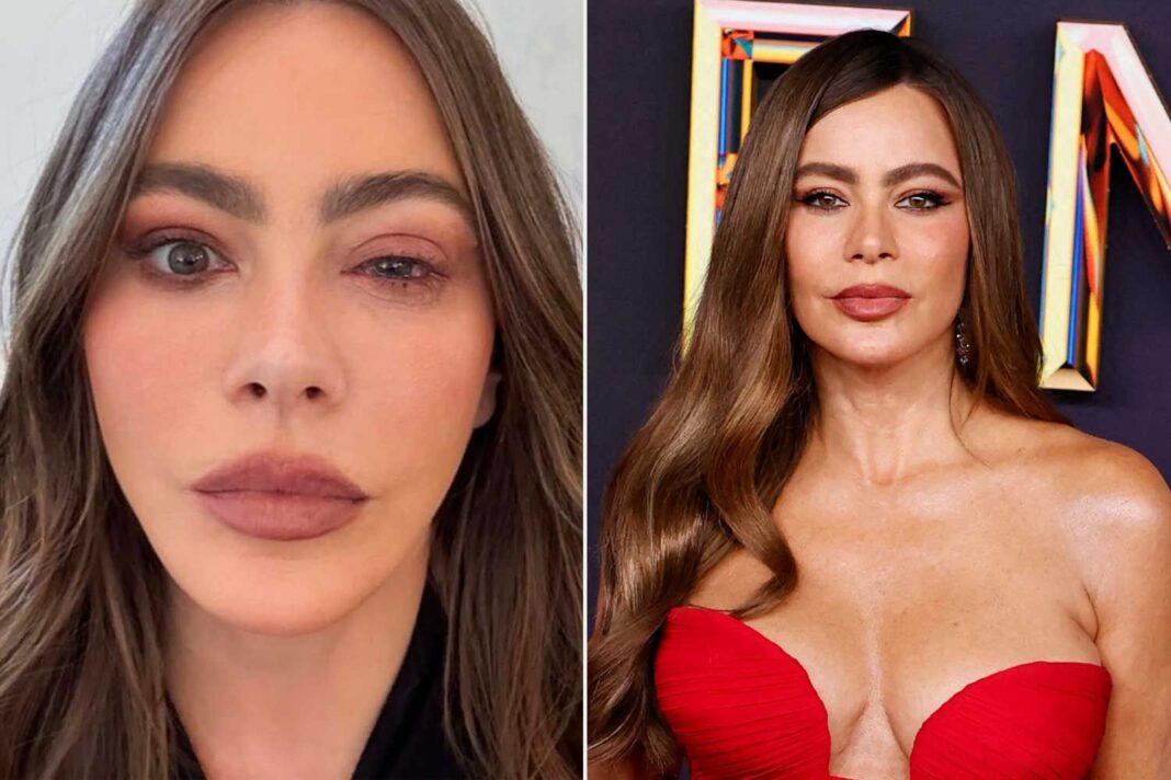 Sofía Vergara Rushed to ER, Misses 77th Emmy Awards Due to “Craziest Eye Allergy”