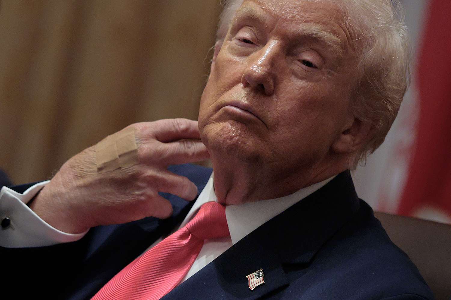 U.S. President Donald Trump wears adhesive bandages on the back of his hand during a meeting of his cabinet in the Cabinet Room of the White House on December 02, 2025 in Washington, DC